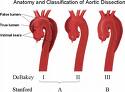 vydut_aorty_priznaky_projevy_klinicke_symptomy.jpg