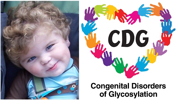 CDG-syndrom-priznaky-projevy-symptomy-obrazek-obrazky-fotografie