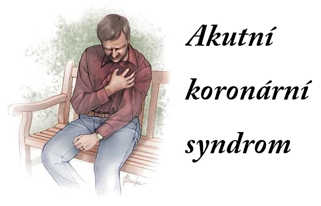 akutni-koronarni-syndrom-priznaky-projevy-symptomy-obrazek-fotografie