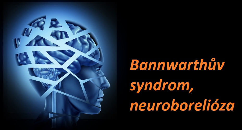 bannwarthuv-syndrom-neuroborelioza-priznaky-projevy-symptomy