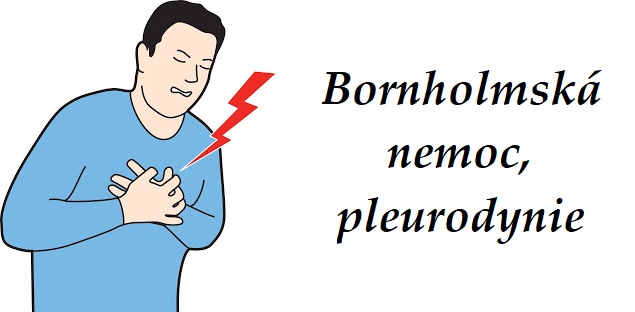 bornholmska nemoc pleurodynie priznaky projevy symptomy pricina lecba