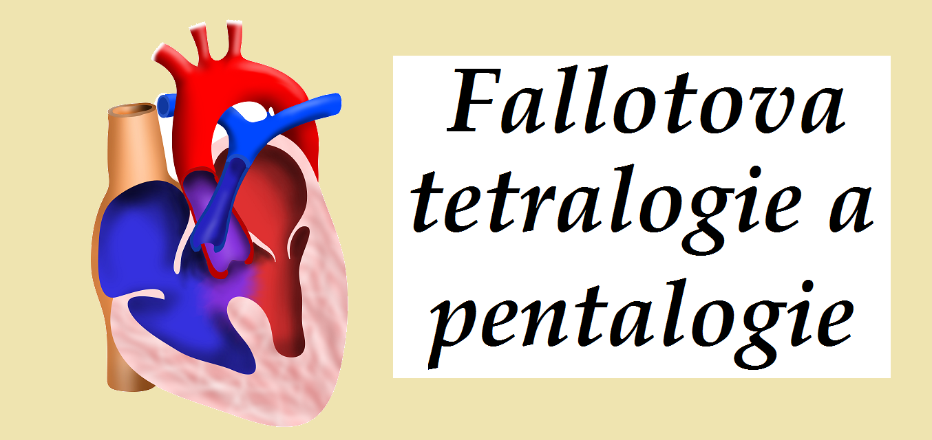 fallotova-tetralogie-a-pentalogie-priznaky-projevy-symptomy