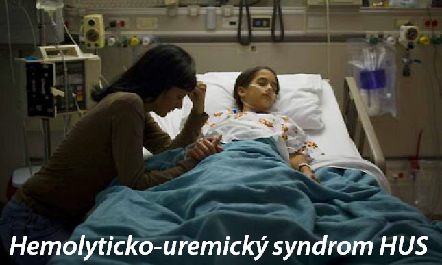 hemolyticko-uremicky-syndrom-hus-priznaky-projevy-symptomy