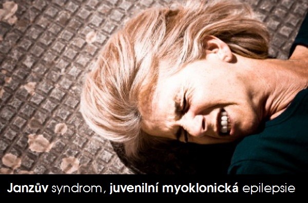 janzuv-syndrom-juvenilni-myoklonicka-epilepsie-priznaky-projevy-symptomy