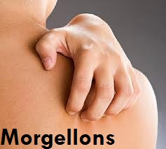 morgellons-syndrom-morgellony-onemocneni-priznaky-projevy-symptomy-15