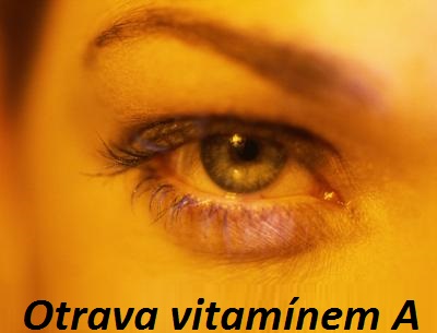 otrava-vitaminem-a-priznaky-projevy-symptomy