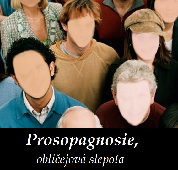 prosopagnosie-oblicejova-slepota-priznaky-projevy-symptomy-2
