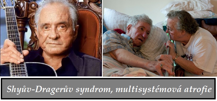 shyuv-drageruv-syndrom-multisystemova-atrofie-priznaky-projevy-symptomy