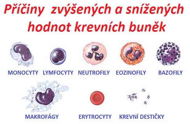 Snížené a zvýšené hodnoty krevních buněk příčina lymfocyty erytrocyty neutrofily trombocyty makrocity mikrocyty eozinofily