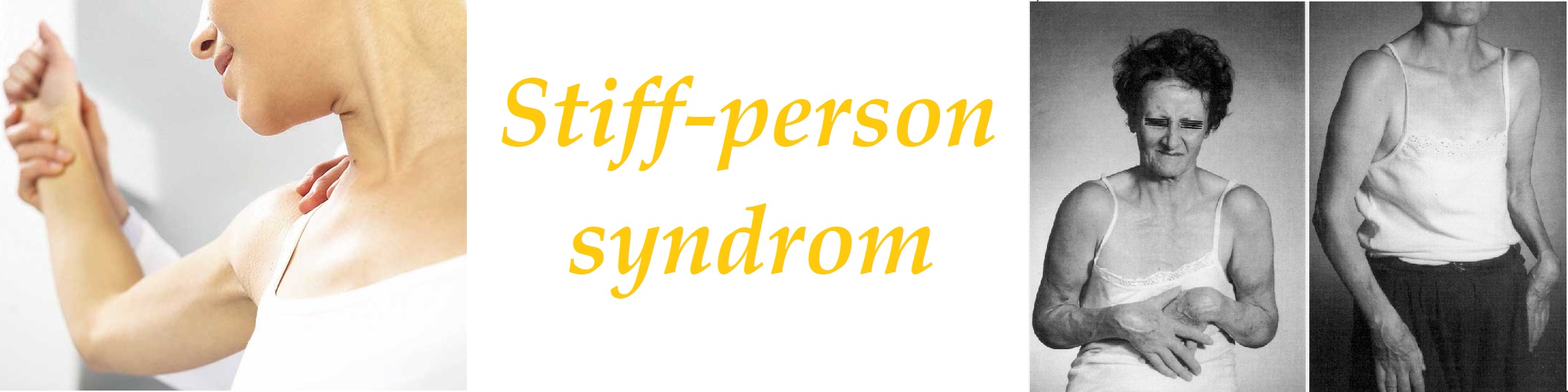 Stiff-person syndrom příznaky projevy léčba příčina symptomy