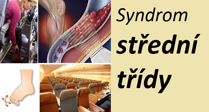 syndrom-stredni-tridy-priznaky-projevy-symptomy