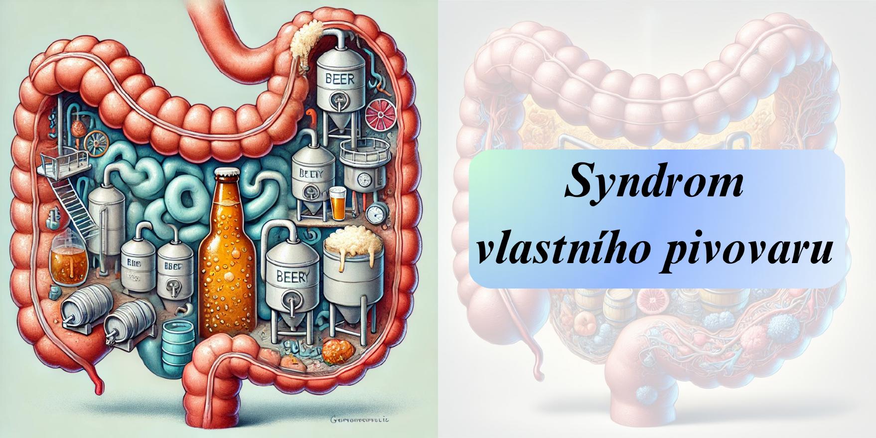 syndrom vlastniho pivovaru priznaky projevy symptomy