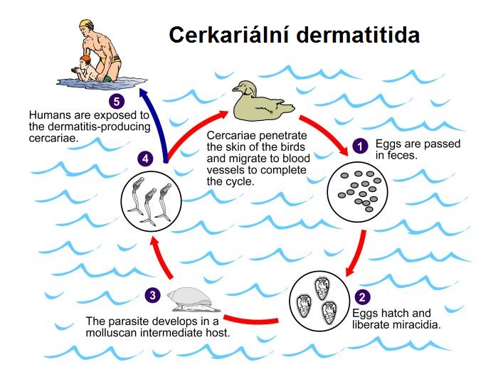 cerkarialni-cerkariova-dermatitida-mnozeni-cerkarii