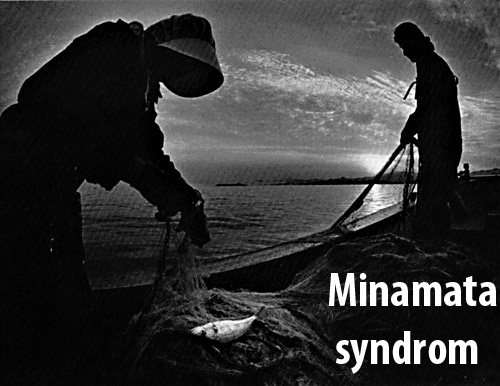 minamata-syndrom-chisso-minimata-syndrom-priznaky-projevy-symptomy-3
