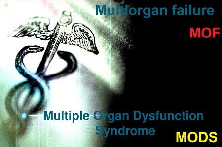 multiorganove-selhani-MODS-priznaky-projevy-symptomy-2